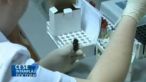 Proteina C reactiva: Un simplu test de sange poate indica riscul de infarct miocardic!
