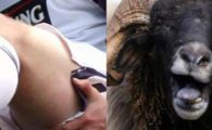 De la placenta umana la voodoo. Vezi TOP&nbsp;10 tratamente bizare