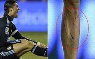 VIDEO Ronaldo vine cu dovada! Vezi cum arata tibia lui Cristiano dupa meciul cu Valladolid!