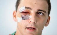 
	FOTO: Cum arata croatul bagat in spital de dinamovistul Pulhac! Se vor razbuna croatii?
