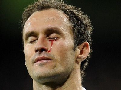 
	Imaginea care a IMPRESIONAT Spania:&nbsp; la Real Madrid se varsa SANGE pentru goluri!
