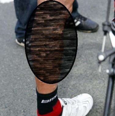 
	FOTO TULBURATOR!!! Cum arata piciorul unui ciclist dupa o etapa din Turul Frantei! CLICK aici daca ai curaj :)
