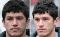 
	FOTO: Daca ar fi avut azi meci, Steaua ar fi jucat in 10 :) Tanase a venit "accidentat" la vizita medicala!
