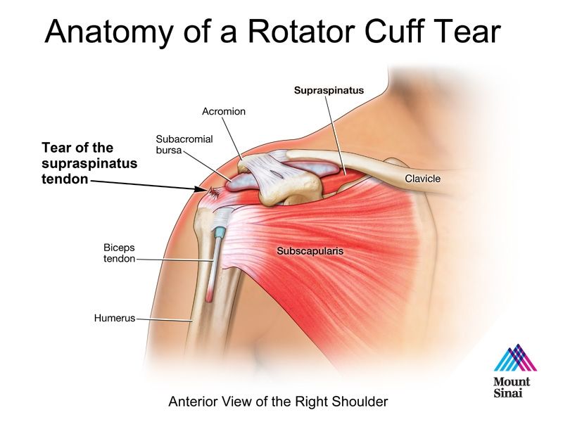 tratamentul simptomelor artrozei infecțioase de ce doare brațul stâng în articulație