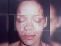 Vezi aici cum arata Rihanna dupa ce a fost batuta de Chris Brown!