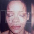 Vezi aici cum arata Rihanna dupa ce a fost batuta de Chris Brown!