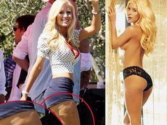 Chiar si cu zece operatii estetice, Heidi Montag nu a scapat de celulita