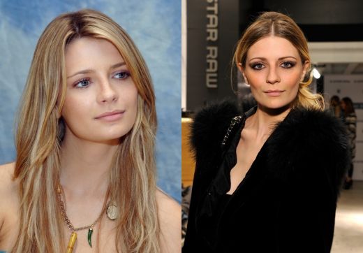 Actrita premiata ca revelatia anului in 2003, Mischa Barton este acum mai cunoscuta pentru problemele alimentare si diete decat pentru rolurile ei. Dupa ce a incheiat filmarile la The O.C., serialul care a facut-o celebra, actrita britanica i-a ingrijorat pe fani si a atras atentia presei cu abuzul de droguri care i-a adus si condamnari, dar si cu oscilatiile de greutate pentru care a fost suspectata ca este anorexica. Actrita nu a mai avut succese majore in cariera dupa terminarea serialului. A mai jucat in seria 