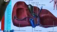 Contraceptivele orale si steroizii pot duce la adenom hepatic
