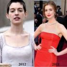 Anne Hathaway, transformare ingrijoratoare pentru rolul din Mizerabilii. Actrita are un corp anorexic si arata ca o fantoma