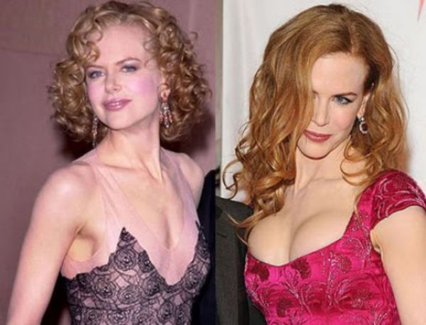 Nicole Kidman