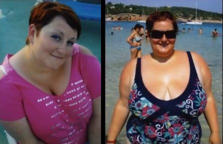 Pierdere în greutate de 40 kg înainte și după