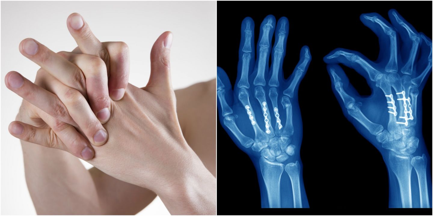 articulațiile la încheietura mâinii tratați articulația degetului mare