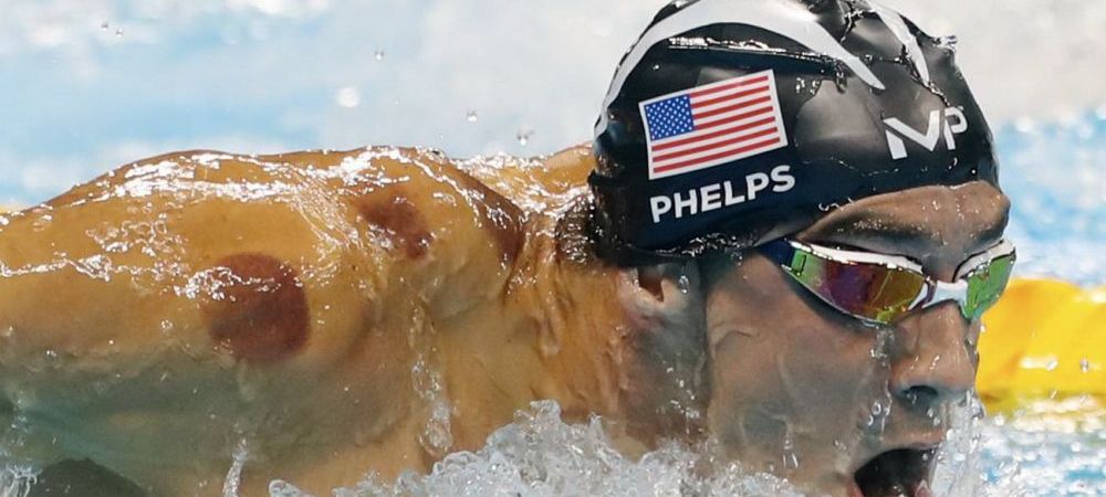 Phelps, acuzat de DOPAJ: <span style="color:#f00;">"Efectele sunt aceleasi cu folosirea de Meldonium!"</span> Rusii explica semnele de pe umarul inotatorului