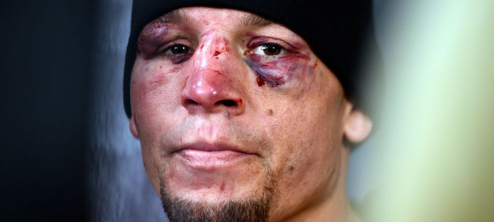 <span style="color:#f00;">"Surprize, surprize, fraiere!</span>" Meci FABULOS intre McGregor si Nate Diaz in aceasta dimineata. <span style="color:#f00;">Irlandezul i-a spart fata "gangsterului" american</span>