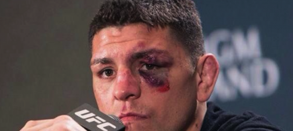 <span style="color:#f00;">N-au stiut ca e fost campion in MMA! </span>Patru barbati au sarit sa-l bata pe Nick Diaz intr-un club de noapte! <span style="color:#f00;">Ce le-a facut luptatorul</span>