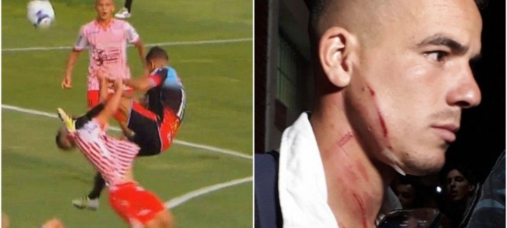 Cel mai <span style="color:#f00;">BRUTAL</span> fault din istorie! <span style="color:#f00;">Tackling CRIMINAL cu urme adanci pe gatul adversarului! </span>VIDEO
