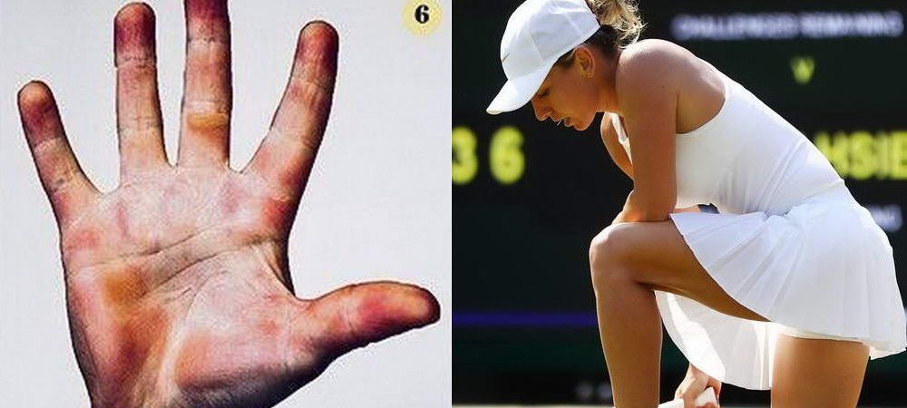 Wimbledon 2018.<span style="color:#f00;"> SACRIFICIUL IMENS al jucatorilor de tenis. Cum arata palmele Simonei Halep si ale altor jucatori de top</span>