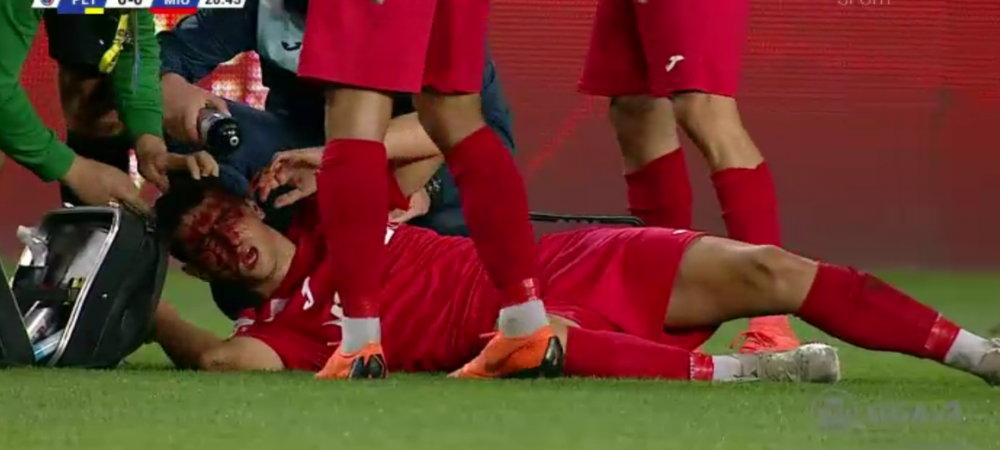 <span style="color:#f00;">SCENE TERIBILE in Liga 2! </span>I-a umplut fata de sange, dar a primit doar cartonasul galben | FOTO