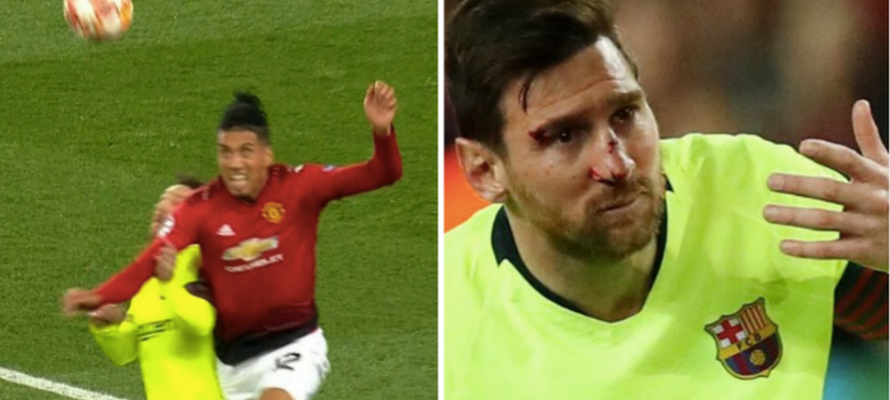 <span style="color:#f00;">Messi, fata in fata cu Smalling la vestiar dupa ce s-a ales cu nasul spart.</span> Cum a reactionat argentinianul