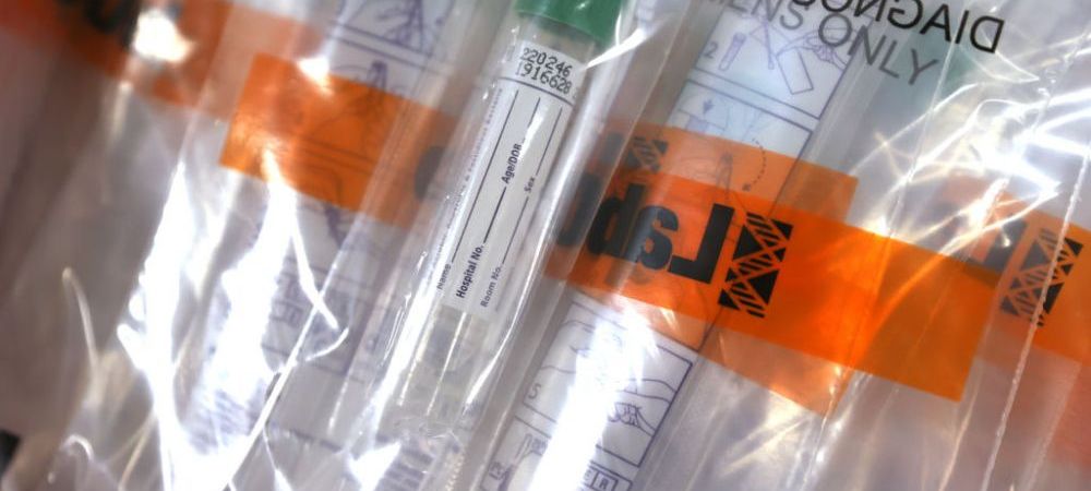 <span style="color:#f00;">Motivul pentru care imigrantii din Suedia sunt mai afectati de coronavirus decat restul populatiei: </span>"A avut un impact diferit"